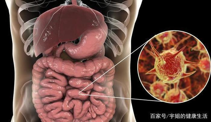 肠道健康养生方面知识；异物卡肠道的表现