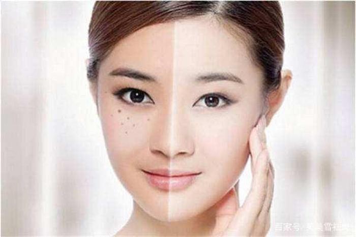 日常生活祛斑小妙招视频，生活小窍门100妙招