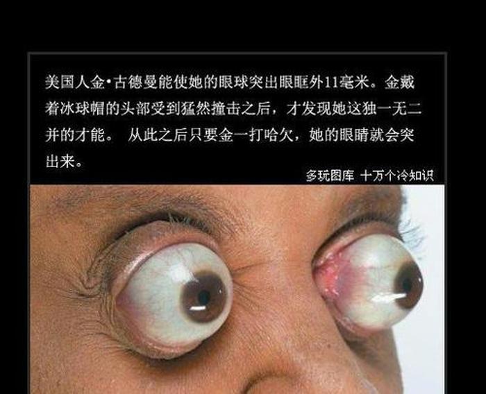 100个有趣的身体冷知识，让人难以相信的冷知识