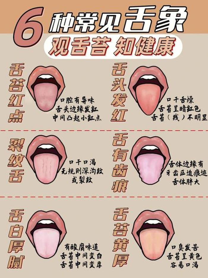 舌头的健康知识科普、舌头的健康状况 图