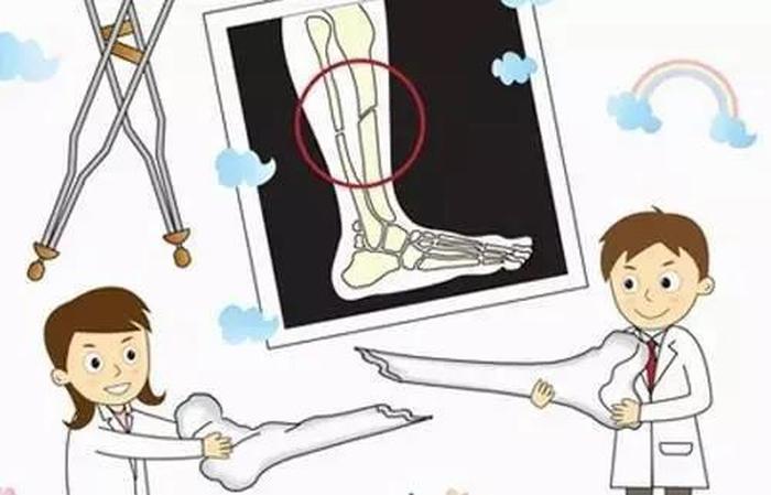 骨科健康科普小知识 骨科健康小常识