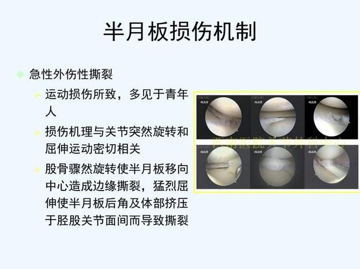 半月板损伤医学知识科普；半月板损伤PPT