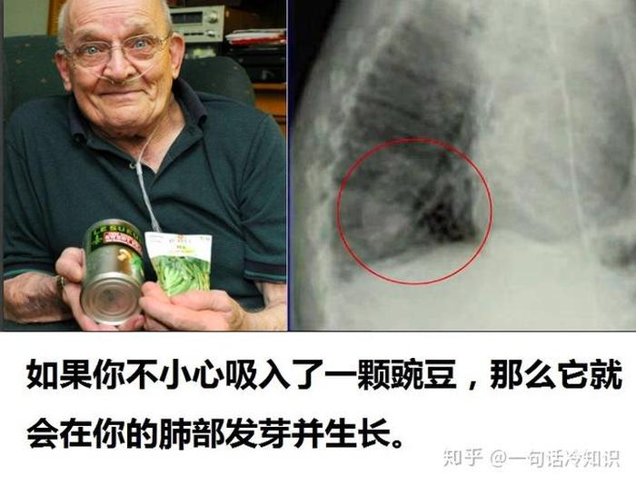 人体奇怪现象冷知识、人体冷知识