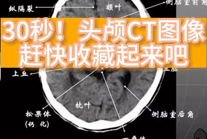 诊断
