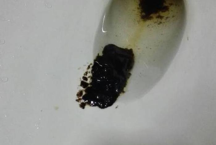 非血性黑便（黑便不是消化道出血）