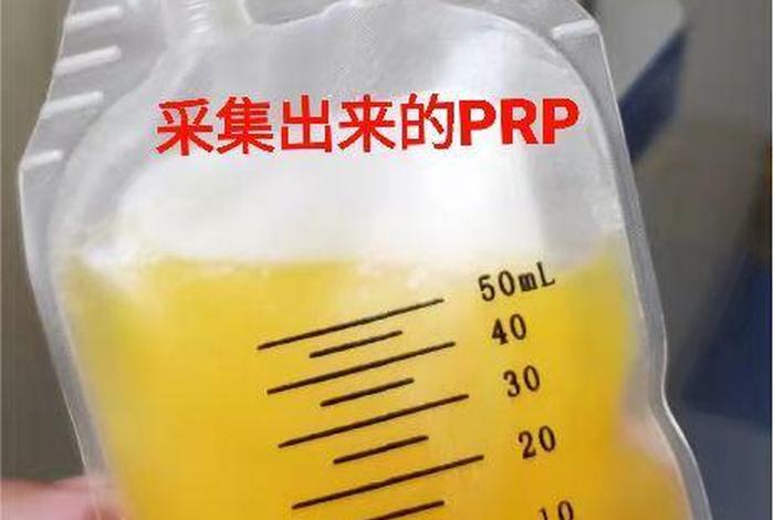 富血小板血浆 - 富血小板血浆治疗股骨头坏死