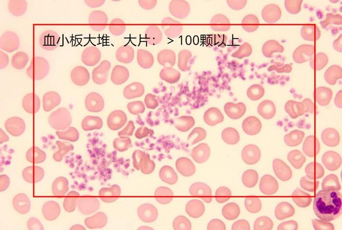 思政血小板（血小板awsl）
