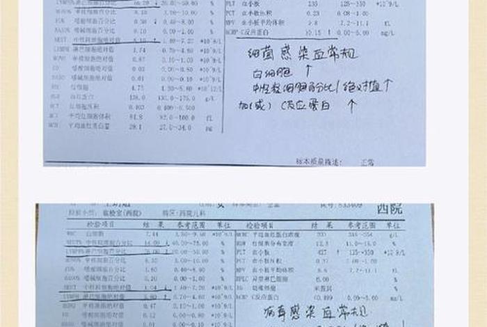 女性血小板正常值最新标准，女性血小板正常值最新标准是