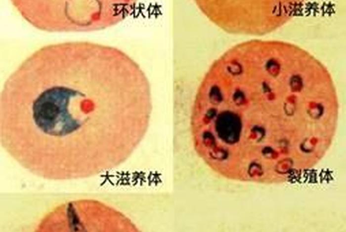 小孩得血吸虫病症状，小孩得了血吸虫病怎么办