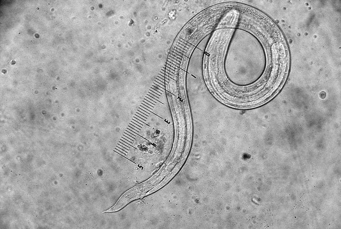 寄生生活的线形动物;线形动物适于寄生生活的结构特点 寄生生活的线形动物;线形动物适于寄生生活的结构特点