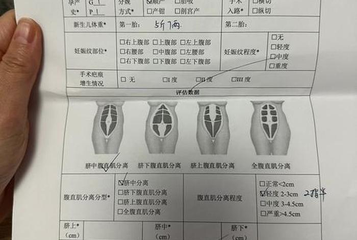 产后生活质量量表 产后身体评估表 产后生活质量量表 产后身体评估表