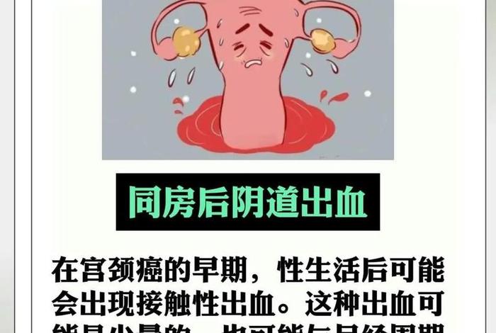 几岁性生活会导致宫颈癌 性生活几年会形成宫颈癌