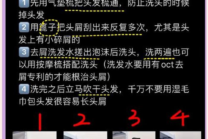 根除头屑妙招窍门 去头屑的小妙方