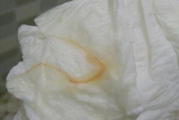 生理活动后白带增多 生理活动后少量出血