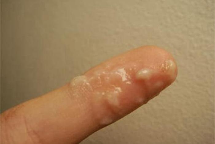 生活糜烂的标准 - 生活糜烂是什么样的