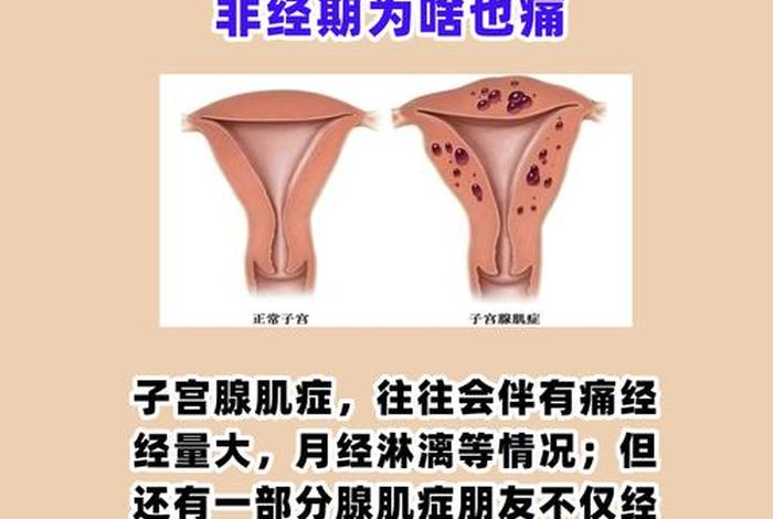 性生活痛经严重(性生活后痛经更严重了) 性生活痛经严重(性生活后痛经更严重了)