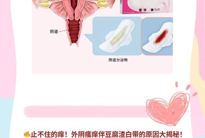 白带像豆渣一样怎么回事,下面瘙痒还有豆腐渣一样的分泌物 白带像豆渣一样怎么回事,下面瘙痒还有豆腐渣一样的分泌物