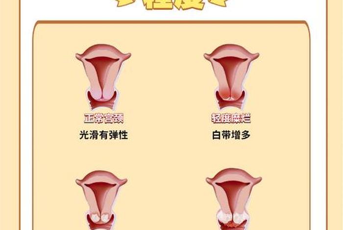 生活糜烂是什么意思 - 生活糜烂的女人的性格分析