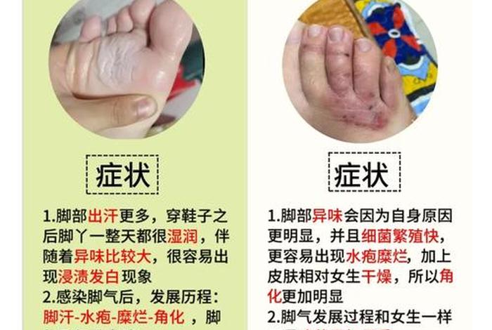 生活窍门小妙招 - 生活窍门小妙招治脚气 生活窍门小妙招 - 生活窍门小妙招治脚气