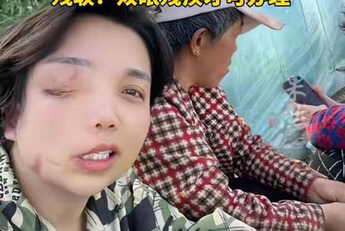 残疾人生活补贴申请怎样写(残疾证生活补贴申请书怎么写) 残疾人生活补贴申请怎样写(残疾证生活补贴申请书怎么写)