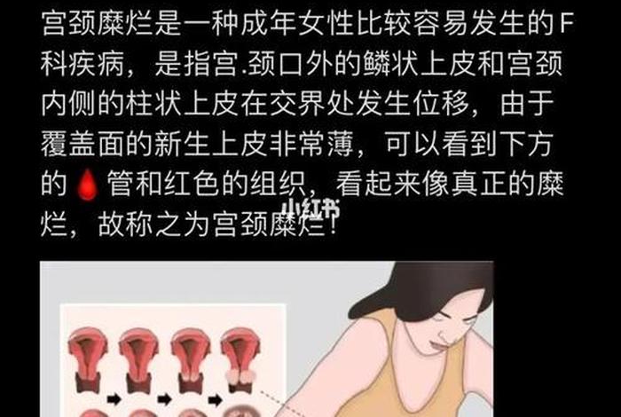 什么是生活糜烂,什么是生活糜烂病 什么是生活糜烂,什么是生活糜烂病