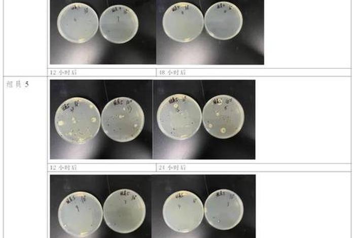 采集生活饮用水水质微生物检测样品时错误的操作是,微生物水样采集注意事项 采集生活饮用水水质微生物检测样品时错误的操作是,微生物水样采集注意事项