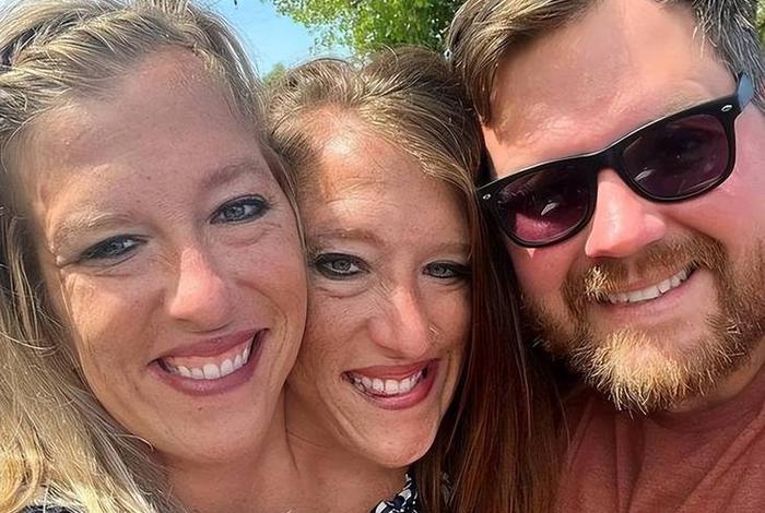 连体人结婚怎么过夫妻生活、连体人结婚怎么办 连体人结婚怎么过夫妻生活、连体人结婚怎么办