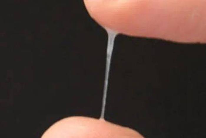 白带带血丝是怎么回事呢,女性分泌物里有血丝是怎么回事 白带带血丝是怎么回事呢,女性分泌物里有血丝是怎么回事