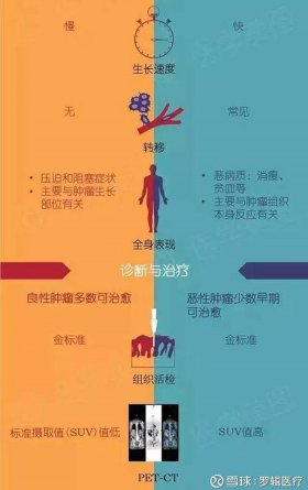 医学常识大全癌症 - 肿瘤相关知识