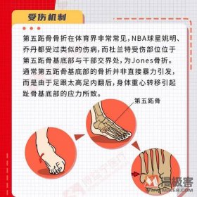 健康科普知识大全骨科 骨科科普文章