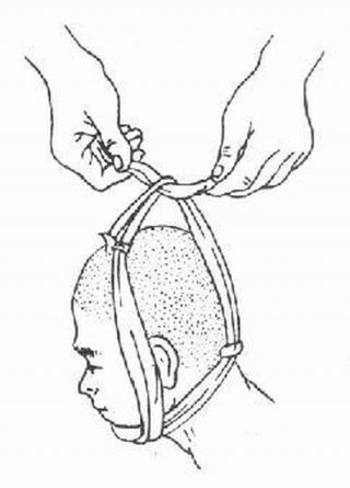 科普生活知识绷带包扎法，头部绷带包扎法视频