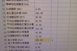 平面血小板体积高 血小板体积平均体积偏高