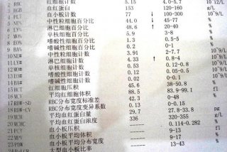 女性血小板计数偏高怎么调理可以降下来；女生血小板计数偏高