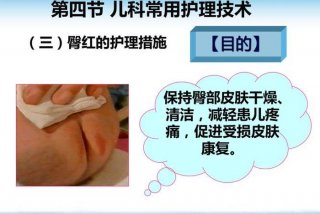 儿科臀部护理操作指导，如何做好患儿的臀部护理