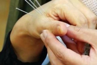 学习针灸视频教程全集 针灸教学视频90集