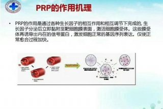 富血小板血浆治疗技术prp 富血小板血浆治疗技术(PRP)