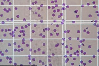 血细胞计数板（血细胞计数板计数室体积）