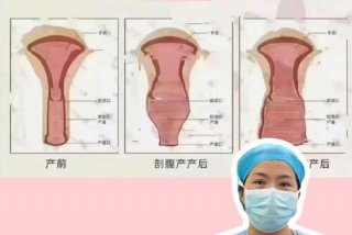 女生产后的生活 - 女性生产后的变化