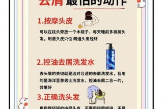 根除头屑妙招窍门 去头屑的小妙方