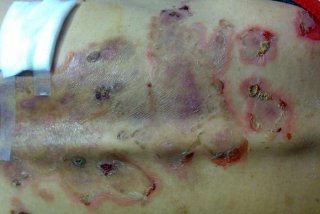 生活糜烂的标准 - 生活糜烂是什么样的