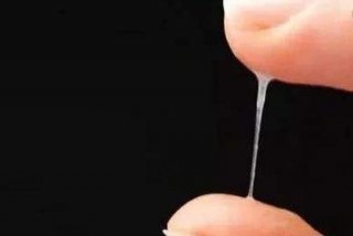 性生活会有白色分泌物是什么，性生活会有白色分泌物是什么情况