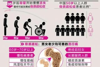 骨质疏松患者正确的生活方式 骨质疏松症调整生活方式是什么