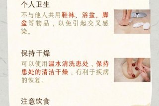 生活窍门小妙招 - 生活窍门小妙招治脚气