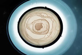 白带呈褐色怎么办、正常的褐色分泌物图片