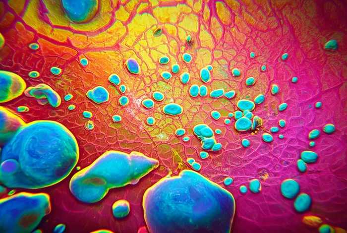 粒系增生活跃,血小板增多什么情况 - 粒系增生活跃,血小板增多什么情况导致的