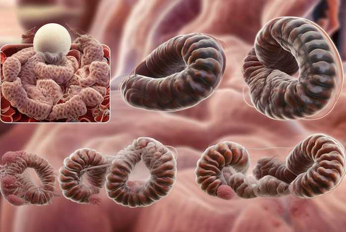 蛔虫病的生活史;蛔虫病的生活史有哪些 蛔虫病的生活史;蛔虫病的生活史有哪些