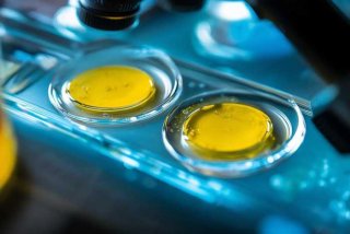 大三阳和小三阳的指标是哪三项 - 大三阳和小三阳的指标是哪三项呢