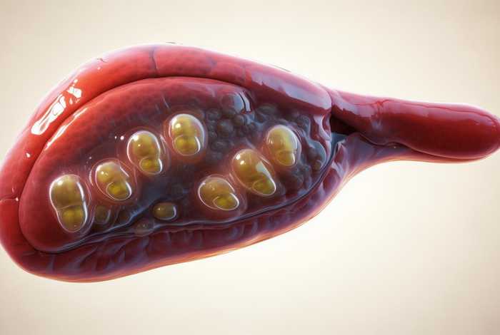 肝吸虫的临床表现，肝吸虫的临床表现有哪些