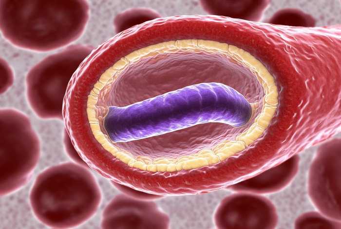 间日疟原虫是什么生物，什么是间日疟原虫病