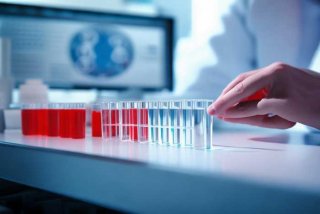 艾滋生活中怎么测出来、艾滋生活中怎么测出来抗体